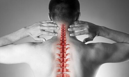 Como a osteocondrose da columna cervical se manifesta